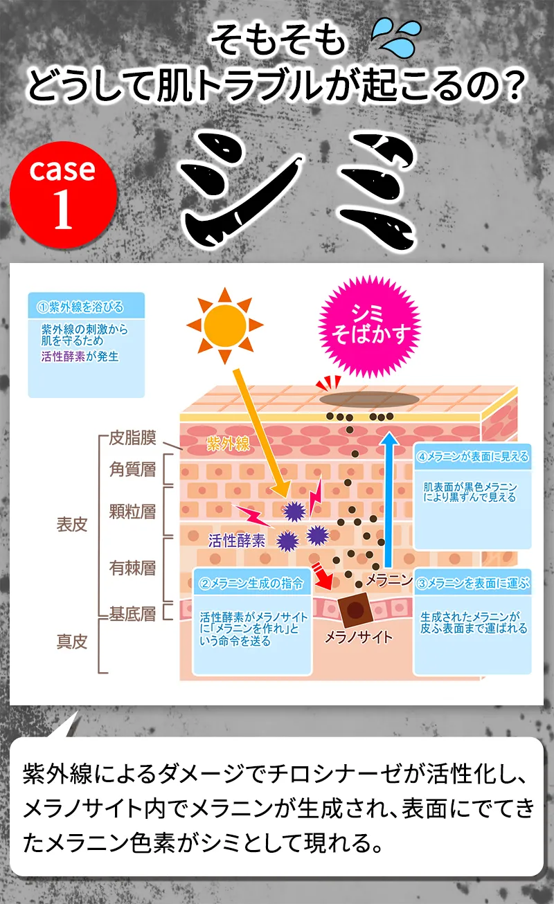 どうして肌トラブルが起こるの？ シミができるメカニズム